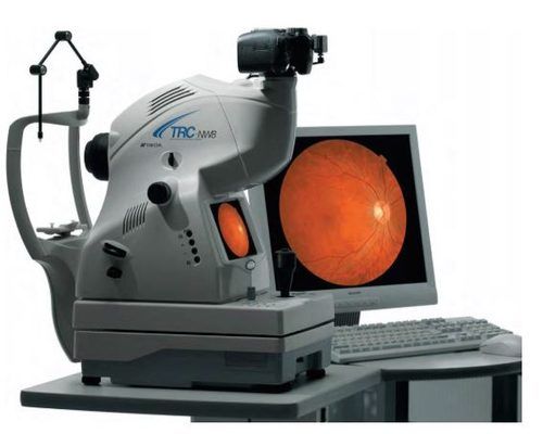 Retinógrafo e Angiografó Digital Topcon TRC-NW8 — Oculare Medical Center Caruaru
